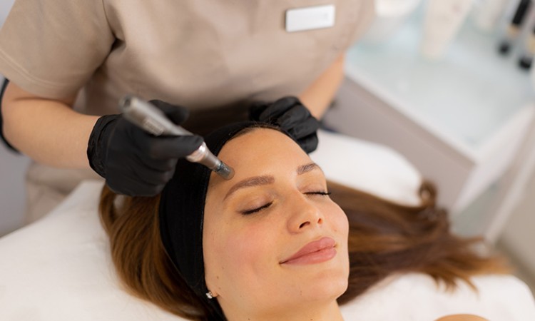 A woman getting a microneedling treatment to her face at a Med Spa location.